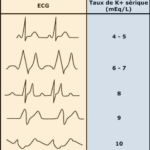 hyperK ad50e5843.gif1746977017