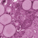 foie 1 5d7e4bb39.jpg1746986266