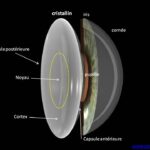 cataracte anatomie coupe oeil