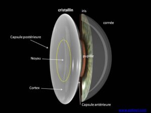 cataracte anatomie coupe oeil