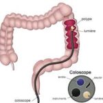 endoscopie voie basse coloscopie anatomie colon