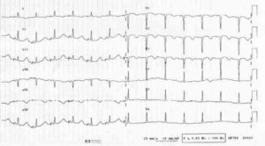 fichier 194