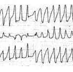 fichier 309