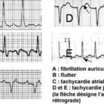 fichier 392