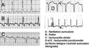 fichier 392