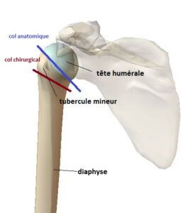 fracture de la tete humerale anatomie epaule