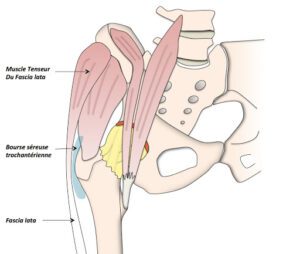 luxation de la hanche anatomie articulation