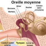 paracentese anatomie oreille