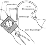 pression arterielle non invasive