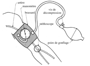 pression arterielle non invasive