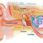 surdite anatomie oreille